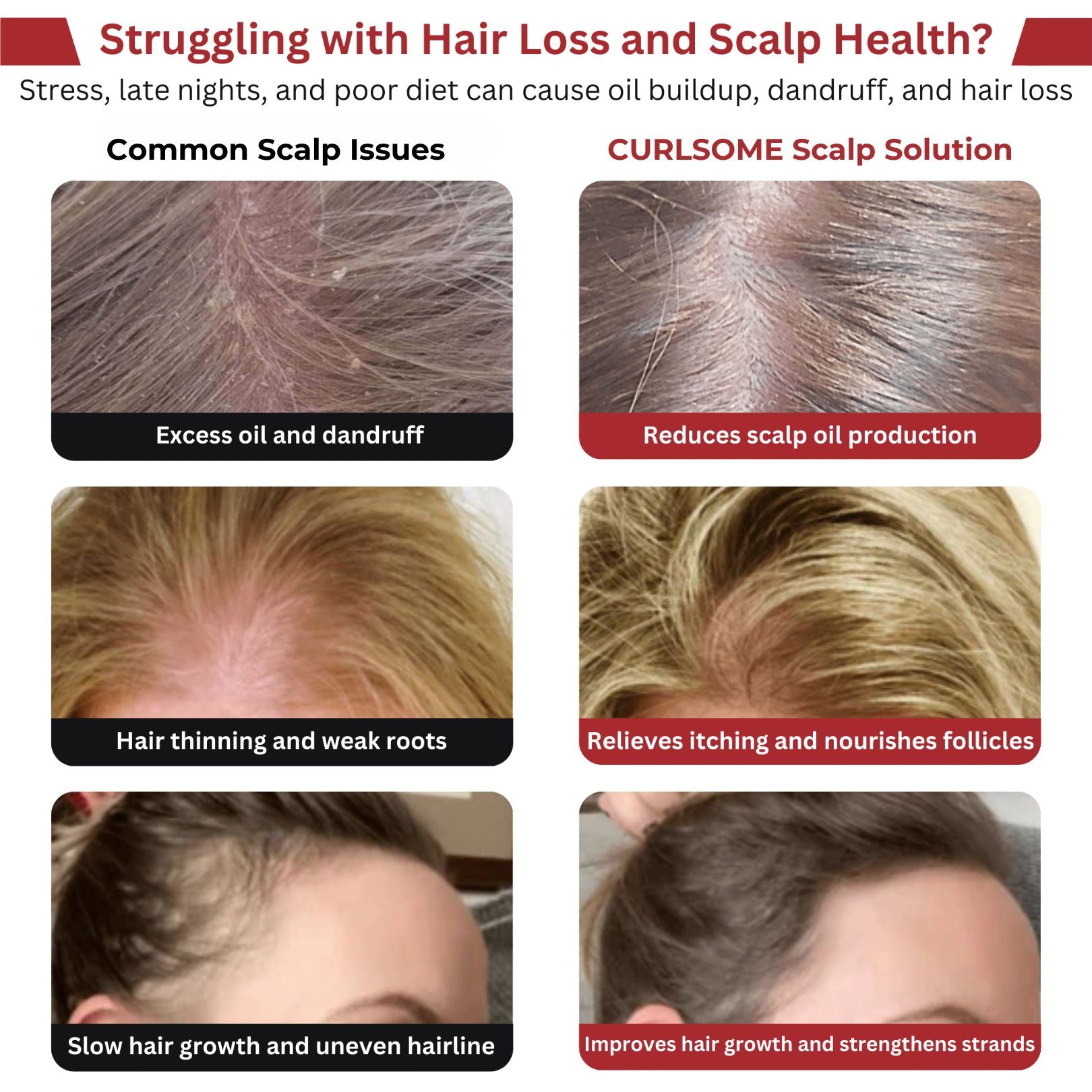 CURLSOME™ 6 IN 1 SCALP THERAPY COMB – RED LIGHT, MASSAGE & SERUM INFUSER